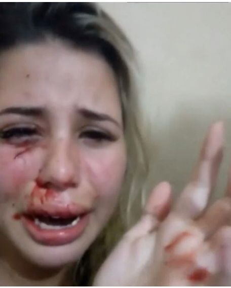 Digital influencer Amanda Souza posta vídeos mostrando lesões no rosto e Vanderlei Bambam é preso em flagrante por agressão
